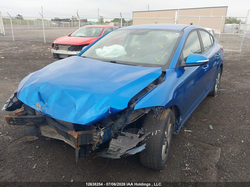 2017 Hyundai Elantra, Удар спереди, IAAI, VIN KMHD84LF3HU102295 — фото 2