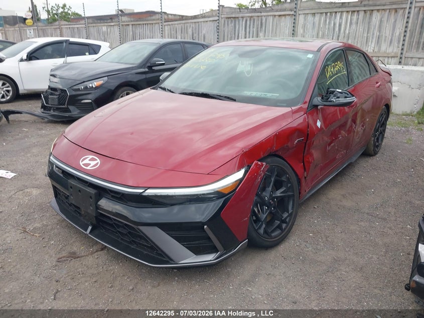 2025 Hyundai Elantra N Line Ultimate, Left Side, IAAI, VIN KMHLR4DF2SU983280 — photo 2