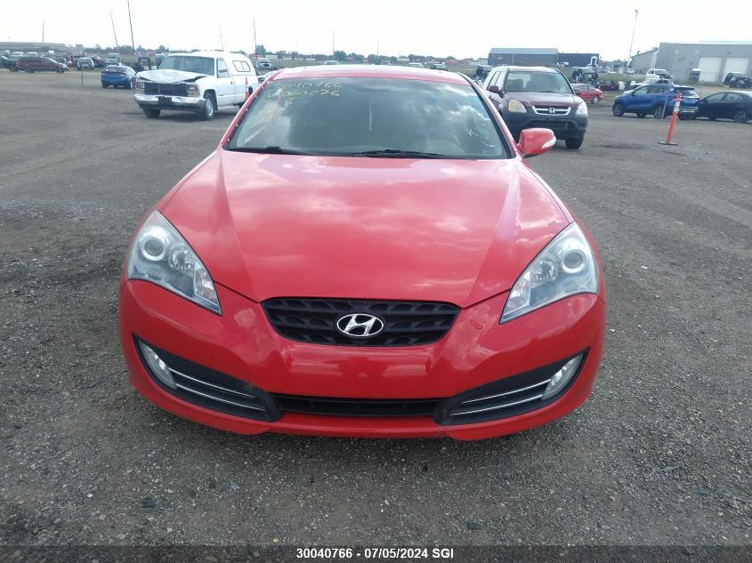 2011 Hyundai Genesis Coupe 3.8L VIN: KMHHU6KH6BU060076 Lot: 30040766