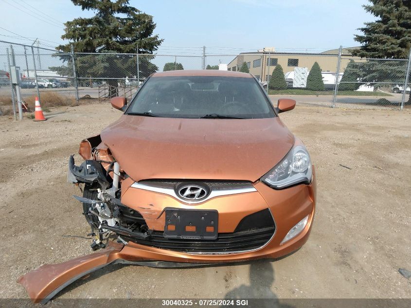 2016 Hyundai Veloster VIN: KMHTC6ADXGU297334 Lot: 30040325