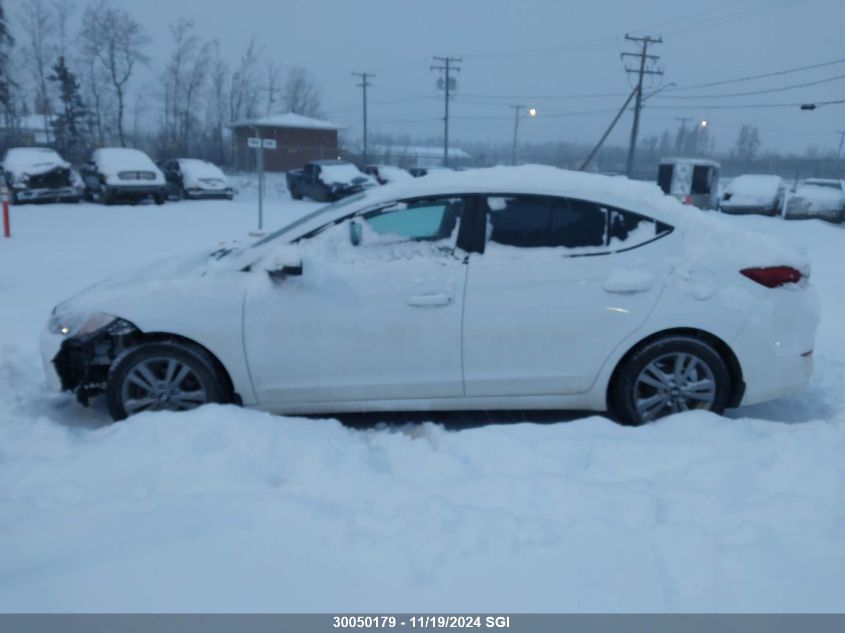 2017 Hyundai Elantra Se/Value/Limited VIN: KMHD84LF6HU419049 Lot: 30050179