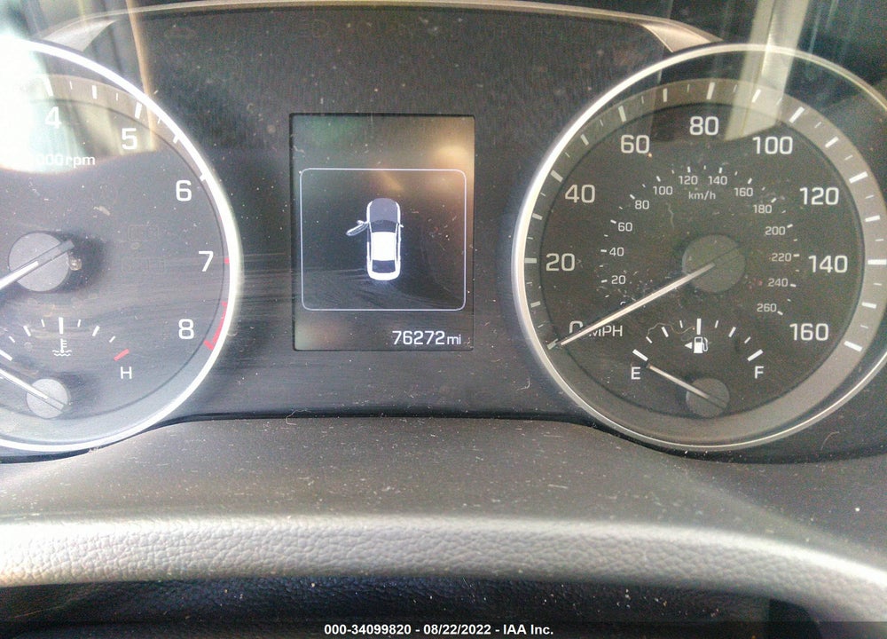 2017 HYUNDAI ELANTRA VIN: KMHD84LF1HU359004