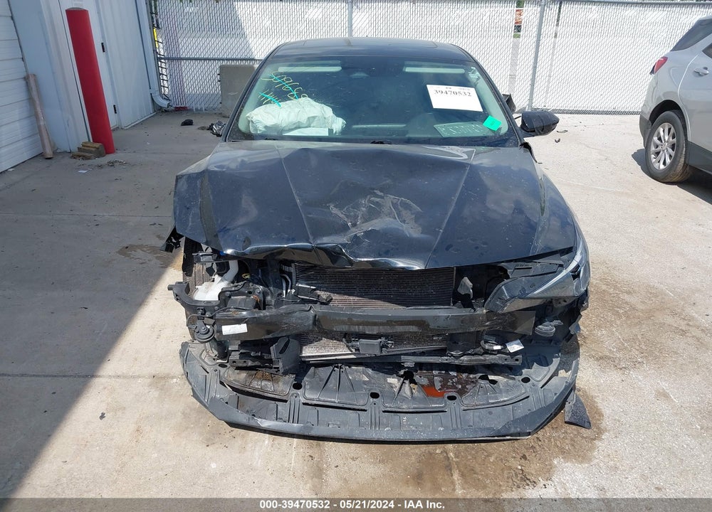 2021 HYUNDAI ELANTRA LIMITED VIN: 5NPLP4AG6MH025330