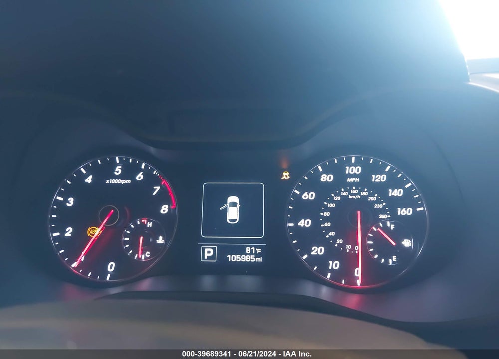 2017 HYUNDAI VELOSTER TURBO VIN: KMHTC6AE6HU312843