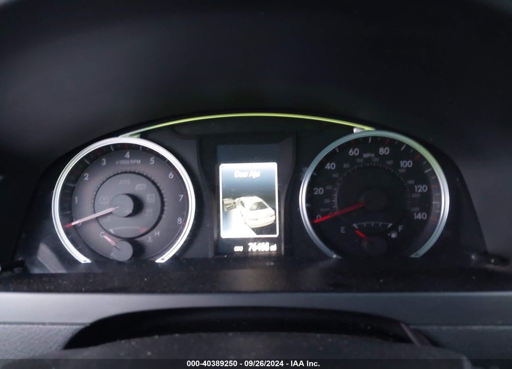 2017 TOYOTA CAMRY SE VIN: 4T1BF1FK7HU393646