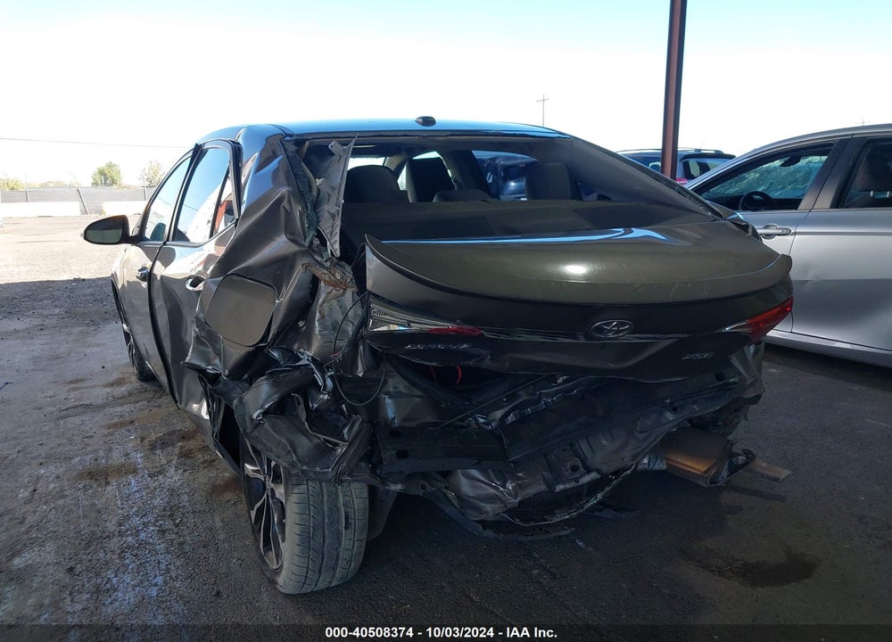 2017 TOYOTA COROLLA XSE VIN: 5YFBURHE5HP685115