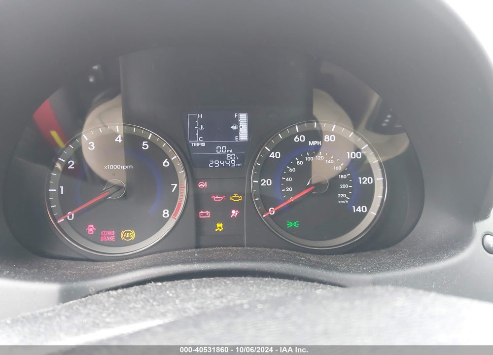 2017 HYUNDAI ACCENT SE VIN: KMHCT4AE9HU271712