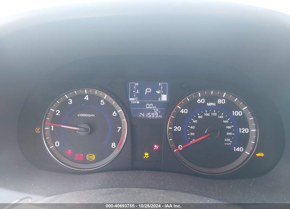 2017 HYUNDAI ACCENT SE VIN: KMHCT4AE9HU283360