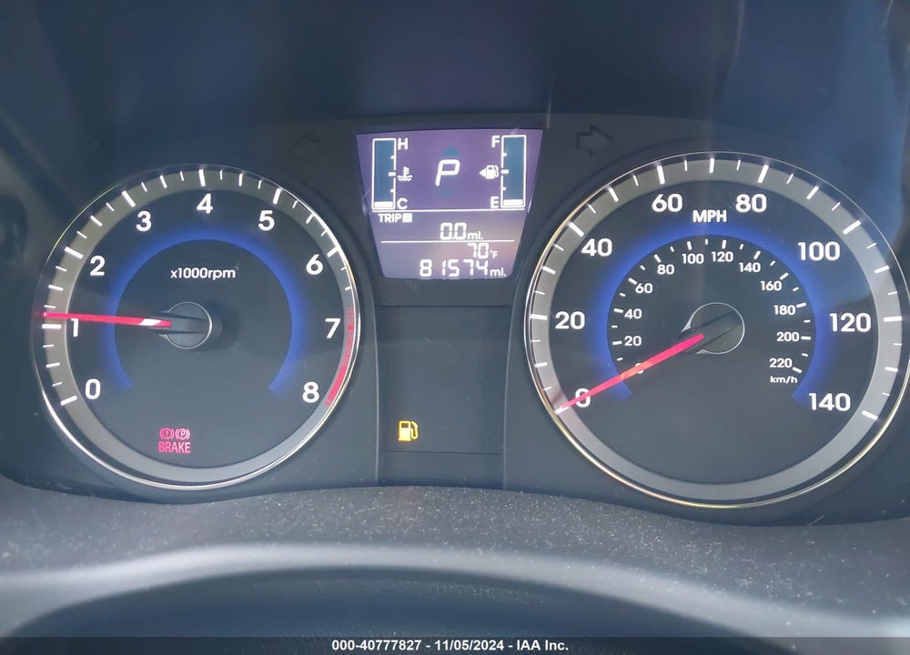 2017 HYUNDAI ACCENT VALUE EDITION VIN: KMHCT4AE6HU361870