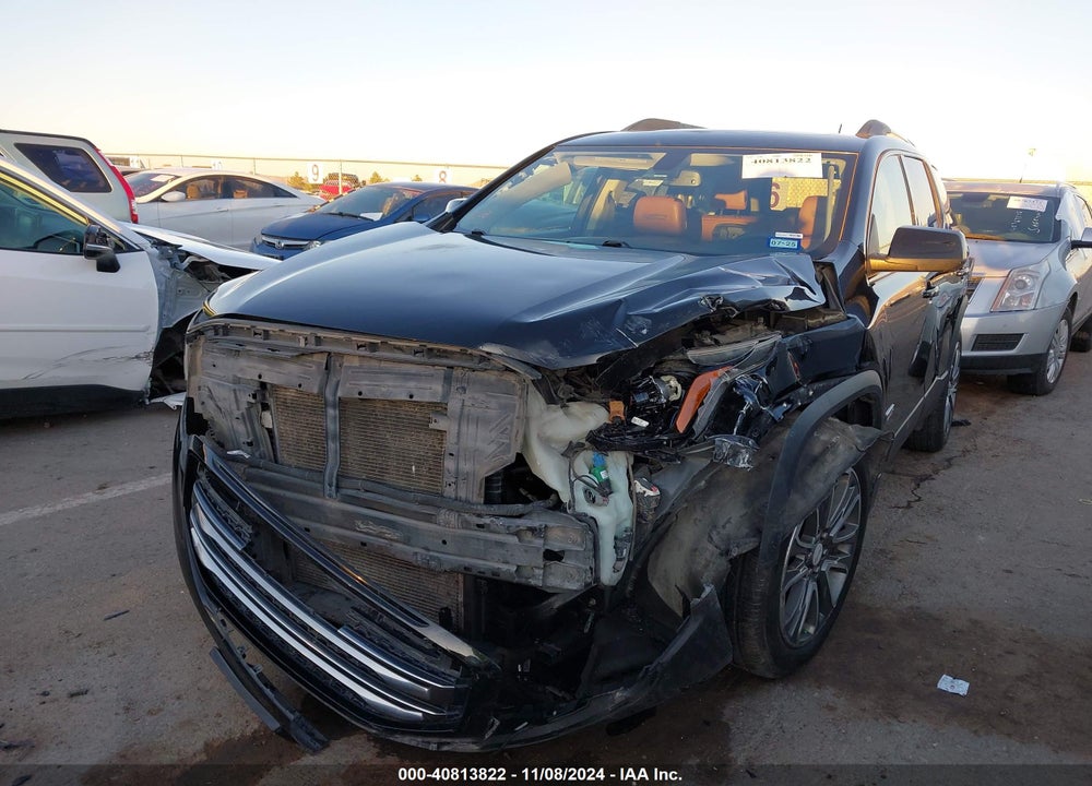 2017 GMC ACADIA SLT-1 VIN: 1GKKNVLS5HZ179491
