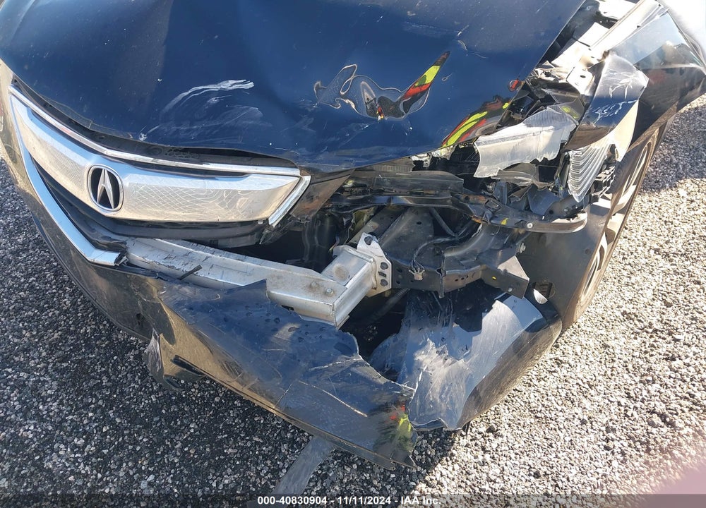 2016 ACURA TLX TECH VIN: 19UUB1F56GA006413