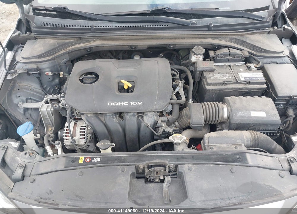 2017 HYUNDAI ELANTRA LIMITED VIN: KMHD84LF0HU283694