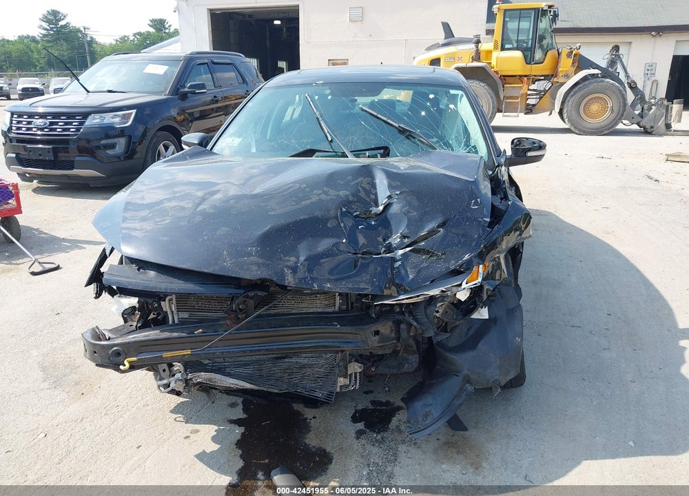 2015 VOLKSWAGEN JETTA 2.0L TDI SE VIN: 3VWLA7AJ4FM328759