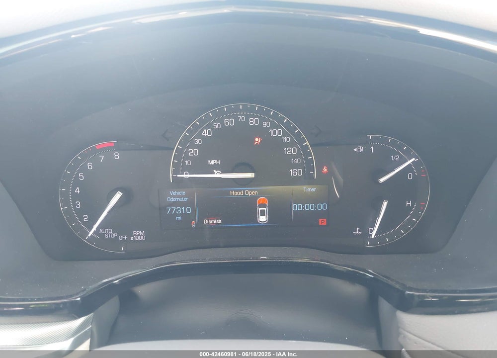 2017 CADILLAC XT5 VIN: 1GYKNBRS1HZ304062