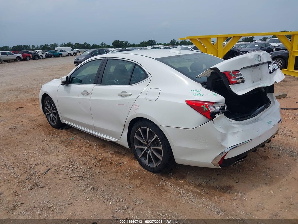 2018 Acura TLX Tech PKG photo 3