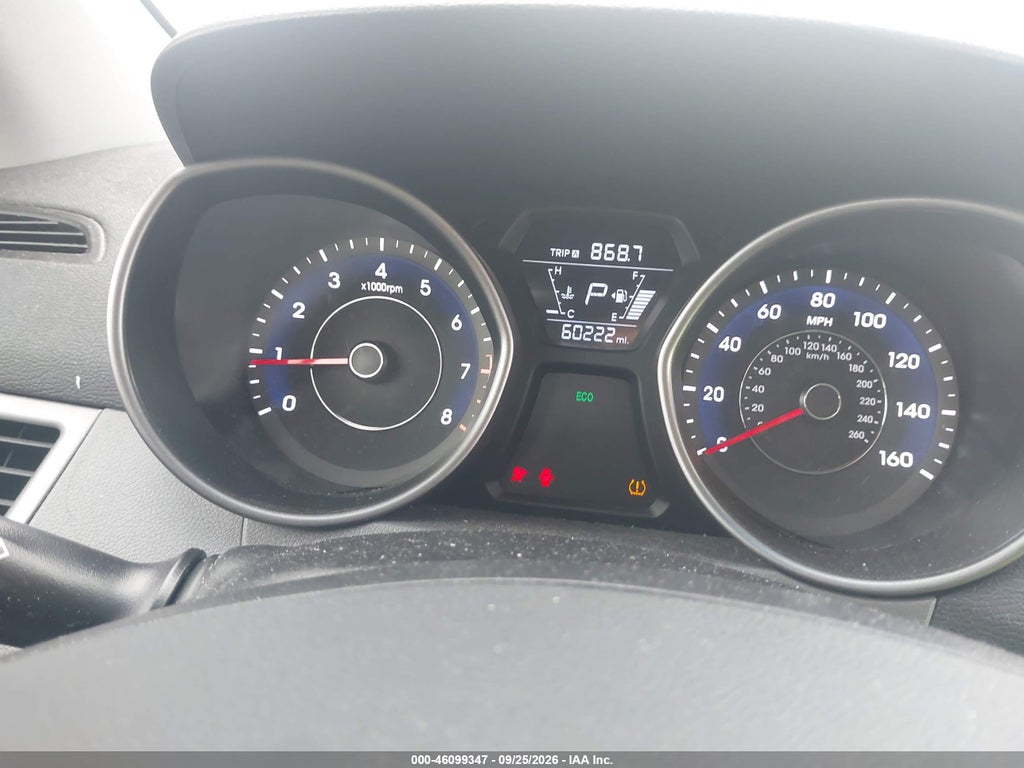 2014 Hyundai Elantra SE photo 7
