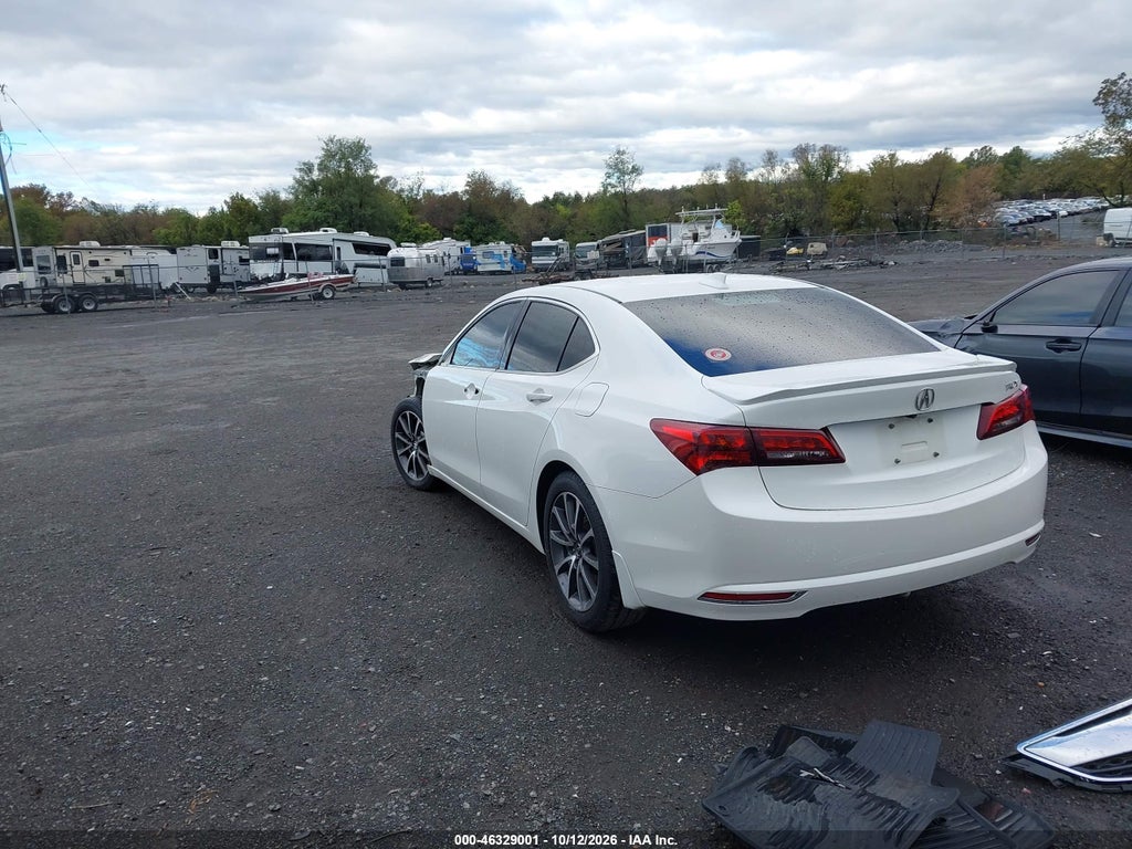 2017 Acura TLX Technology Package photo 3