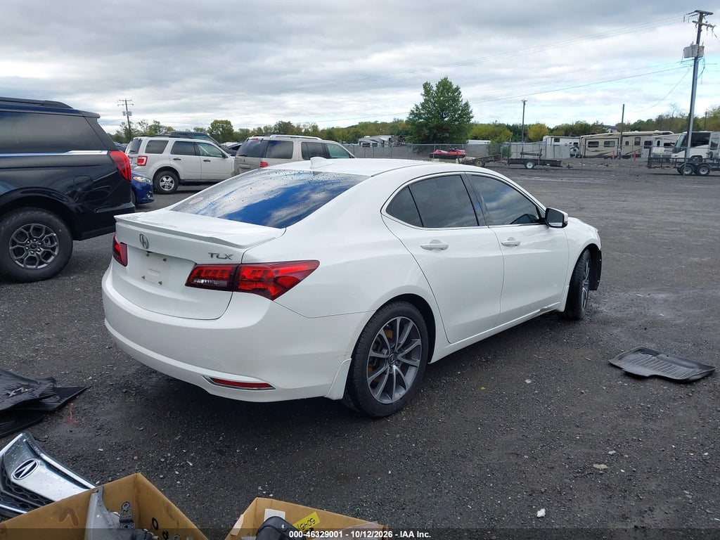 2017 Acura TLX Technology Package photo 4