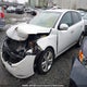 KNAFW5A3XB5430426 2011 Kia Forte Sx auction photo thumbnail 2