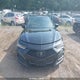 19UUB6F53NA003883 2022 Acura Tlx A-Spec Package auction photo thumbnail 11
