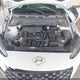KM8K3CAB1PU017793 2023 Hyundai Kona Sel auction photo thumbnail 10