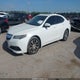 19UUB1F38HA002136 2017 Acura Tlx auction photo thumbnail 2