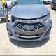 19UUB5F57NA005596 2022 Acura Tlx A-Spec Package auction photo thumbnail 6