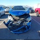 4T1BF1FK6GU518800 2016 Toyota Camry Se auction photo thumbnail 11