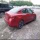 3N1AB8CV9RY325904 2024 Nissan Sentra Sv Xtronic Cvt auction photo thumbnail 4