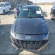 5NPLL4AG9MH045695 2021 Hyundai Elantra Se auction photo thumbnail 12