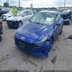 5NPLS4AG9NH076742 2022 Hyundai Elantra Sel auction photo thumbnail 2