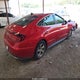 5NPEG4JA0MH118459 2021 Hyundai Sonata Se auction photo thumbnail 4