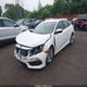 19XFC2F59HE072530 2017 Honda Civic Lx auction photo thumbnail 2