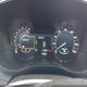 5LMCJ1C95HUL27646 2017 Lincoln Mkc Premiere auction photo thumbnail 7
