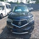 5J8YD4H91JL005940 2018 Acura Mdx Advance Entertainment Pkgs auction photo thumbnail 12