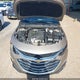 1G1ZD5ST3SF147860 2025 Chevrolet Malibu Fwd 1Lt auction photo thumbnail 10