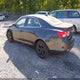1G11C5SA3GU130395 2016 Chevrolet Malibu Limited Lt auction photo thumbnail 3