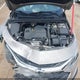 1G1ZG5ST2NF152124 2022 Chevrolet Malibu Fwd Rs auction photo thumbnail 17