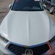 19UUB2F38JA000544 2018 Acura Tlx auction photo thumbnail 6