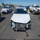 3VWDB7AJ8HM287296 2017 Volkswagen Jetta 1.4T Se auction photo thumbnail 13