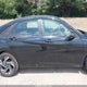 KMHLM4DG1SU001505 2025 Hyundai Elantra Sel Sport auction photo thumbnail 14