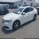 19UUB1F33FA028558 2015 Acura Tlx auction photo thumbnail 2