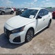 1N4BL4DV2SN330165 2025 Nissan Altima Sv Fwd auction photo thumbnail 2