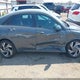 KMHLM4DG2SU943286 2025 Hyundai Elantra Sel Sport auction photo thumbnail 13