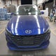 5NPLL4AG8MH035501 2021 Hyundai Elantra Se auction photo thumbnail 13