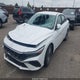 KMHLM4DG5RU819703 2024 Hyundai Elantra Sel auction photo thumbnail 2