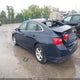 1G1ZB5ST0HF175680 2017 Chevrolet Malibu Ls auction photo thumbnail 3