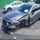 19UUB5F50NA000644 2022 Acura Tlx A-Spec Package auction photo thumbnail 6