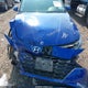 5NPLL4AG1MH040359 2021 Hyundai Elantra Se auction photo thumbnail 12