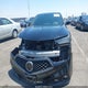 19UUB2F65KA001310 2019 Acura Tlx Tech A-Spec Pkgs auction photo thumbnail 13